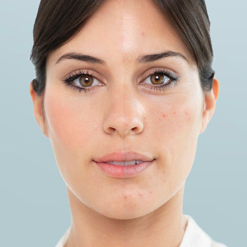 #WELLPOD Facial Sauna